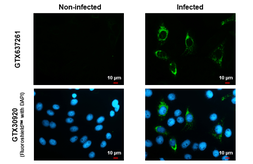 Anti-Zika virus NS4B protein antibody [HL1663] used in Immunocytochemistry/ Immunofluorescence (ICC/IF). GTX637261